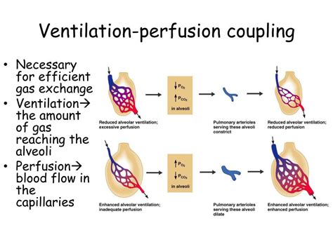 what is ventilation perfusion coupling|relationship between ventilation and perfusion.